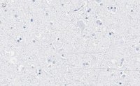 Anti-GAD65 Antibody, clone 3B23 ZooMAb Rabbit Monoclonal 