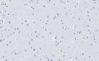 Anti-GAD67 Antibody, clone 4B5 ZooMAb Rabbit Monoclonal 