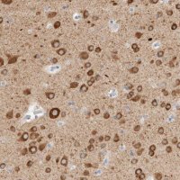 Anti-GADD45G antibody produced in rabbit HPA023606-100UL