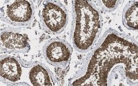 Anti-GAPDH Antibody, clone 10B13, ZooMAb Rabbit Monoclonal 