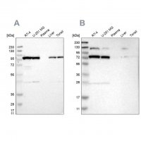 Anti-GARS antibody produced in rabbit 
