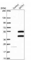 Anti-GATA1 antibody produced in rabbit HPA000232-100UL