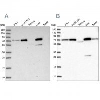 Anti-GBE1 antibody produced in rabbit HPA038073-100UL