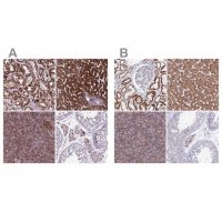 Anti-GCDH antibody produced in rabbit 