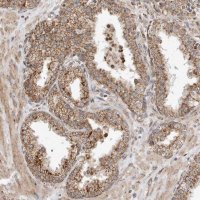 Anti-GCNT2 antibody produced in rabbit 
