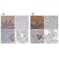 Anti-GDAP1 antibody produced in rabbit 