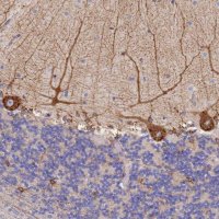 Anti-GDAP2 antibody produced in rabbit 