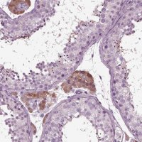 Anti-GDF11 antibody produced in rabbit 