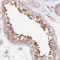 Anti-GEMIN2 antibody produced in rabbit 