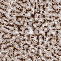 Anti-GGH antibody produced in rabbit 