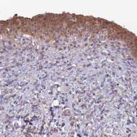 Anti-GIPC1 antibody produced in rabbit 