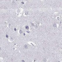 Anti-GJA8 antibody produced in rabbit 