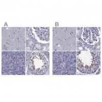 Anti-GKAP1 antibody produced in rabbit 