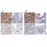 Anti-GLA antibody produced in rabbit 