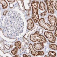 Anti-GLS antibody produced in rabbit HPA036223-100UL
