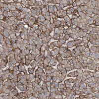 Anti-GLT8D2 antibody produced in rabbit 