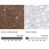 Anti-GLUL antibody produced in rabbit 