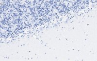 Anti-GluR-2 Antibody, clone 1K20 ZooMAb Rabbit Monoclonal 