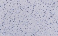 Anti-GluR1 Antibody, clone RH95 ZooMAb Mouse Monoclonal 