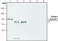 Anti-Glycogen Synthase 2 (C-terminal) antibody produced in rabbit SAB4200295-200UL