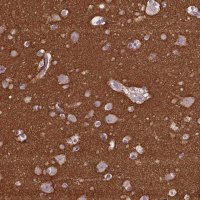 Anti-GNAO1 antibody produced in rabbit 
