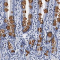 Anti-GNAS antibody produced in rabbit 