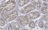 Anti-Golgin-97 Antibody, clone 4K16, ZooMAb Rabbit Monoclonal 