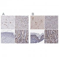 Anti-GOLIM4 antibody produced in rabbit 
