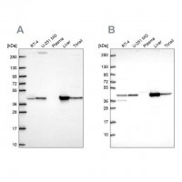 Anti-GOT1 antibody produced in rabbit HPA072629-100UL