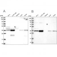 Anti-GPATCH11 antibody produced in rabbit 