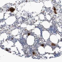Anti-GPATCH3 antibody produced in rabbit 