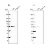 Anti-GPI antibody produced in rabbit 