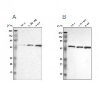 Anti-GPKOW antibody produced in rabbit 