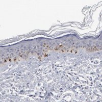 Anti-GPR143 antibody produced in rabbit 