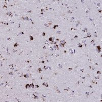 Anti-GPR162 antibody produced in rabbit HPA055135-100UL