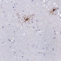 Anti-GPR17 antibody produced in rabbit 
