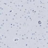 Anti-GPR18 antibody produced in rabbit 