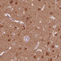 Anti-GPRIN1 antibody produced in rabbit 