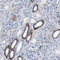 Anti-GRAMD1A antibody produced in rabbit 