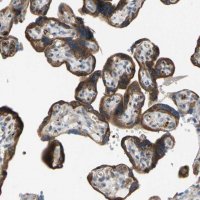 Anti-GRAMD3 antibody produced in rabbit HPA009678-100UL