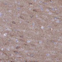 Anti-GRIA2 antibody produced in rabbit 