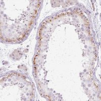 Anti-GRID2 antibody produced in rabbit 