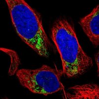Anti-GRK6 antibody produced in rabbit 