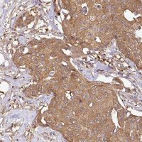 Anti-GSPT1 antibody produced in rabbit 