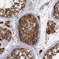Anti-GSTM3 antibody produced in rabbit 