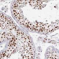 Anti-GTF2H1 antibody produced in rabbit 
