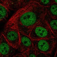 Anti-GTF3C5 antibody produced in rabbit 