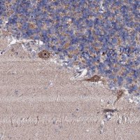 Anti-GTPBP4 antibody produced in rabbit 