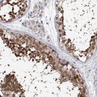 Anti-GTSF1 antibody produced in rabbit 