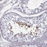 Anti-GTSF1L antibody produced in rabbit 